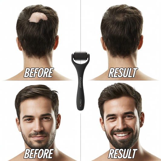 Traitement de microneedling : guide complet des bénéfices et résultats 2026