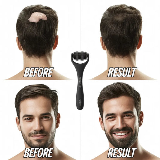 Traitement de microneedling : guide complet des bénéfices et résultats 2026 ACTIVE GROW